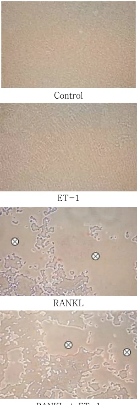 Fig. 7. Resorption pit formation by mature osteoclasts.