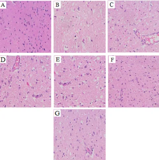 Fig. 2. Effect of rhGLP-1 (7-36) on the infarction volumes of McAo/r diabetic rats. (A) Typical TTC stained brain slices of MCAO/R rats in different  groups