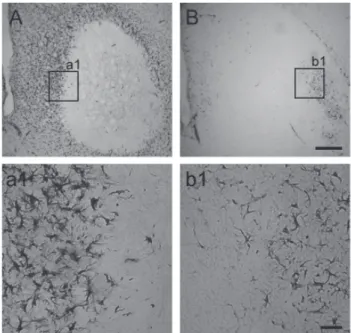 Fig. 5. Astrocyte activation in the striatum. Representative images  of GFAP immunoreactivity were shown from vehicle-treated animals (A  and a1) and CAPE-treated animals (B and b1)