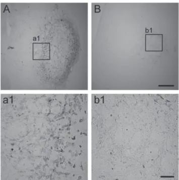 Fig. 6. Microglia/macrophage activation in the striatum. Repre- Repre-sentative images of immunoreactivity to CD45, a marker of activated  microglia/macrophages, were shown from vehicle-treated animals (A  and a1) and CAPE-treated animals (B and b1)