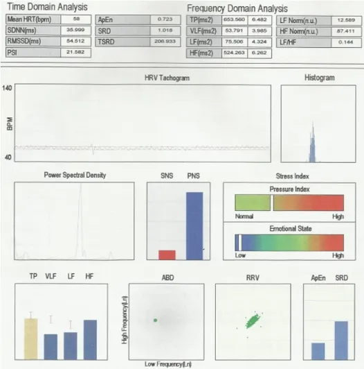 Fig. 2. Five-minute time &amp; frequency domain indices of heart rate variability (case 2)환자는 검사하기 전 운동이나 알코올 복용, 커피복용 등의 행위를 금지하였으며 편안한 상태에서 5분간 측정하였다