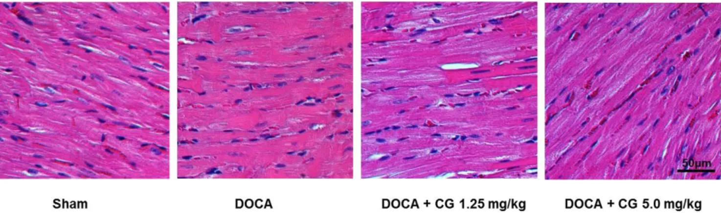 Fig. 5. Effect of CG200745 on expression of cardiac hypertrophic genes in deoxycorticosterone acetate (DOCA)-induced hypertensive  rats