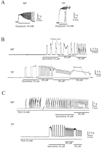 Fig. 1. Effect of quinidine on the isometric contraction of uterine  longitudinal muscle in mice