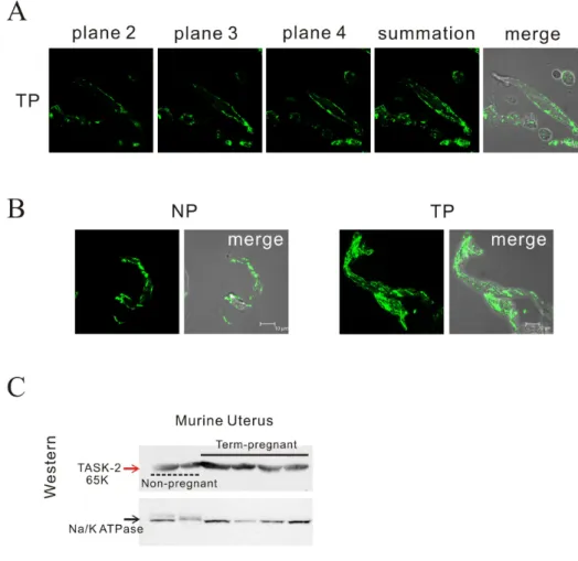 Fig. 5. Identification of TASK-2 by  immunohistochemistry and Western  blot in mouse myometrium