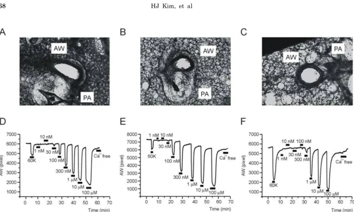 Fig. 2. Representative cases of PCLS experiment. Images of mouse lung slices taken from PCLS preparations; Control (A), Ova-asthma  (B), and IL-13TG (C)
