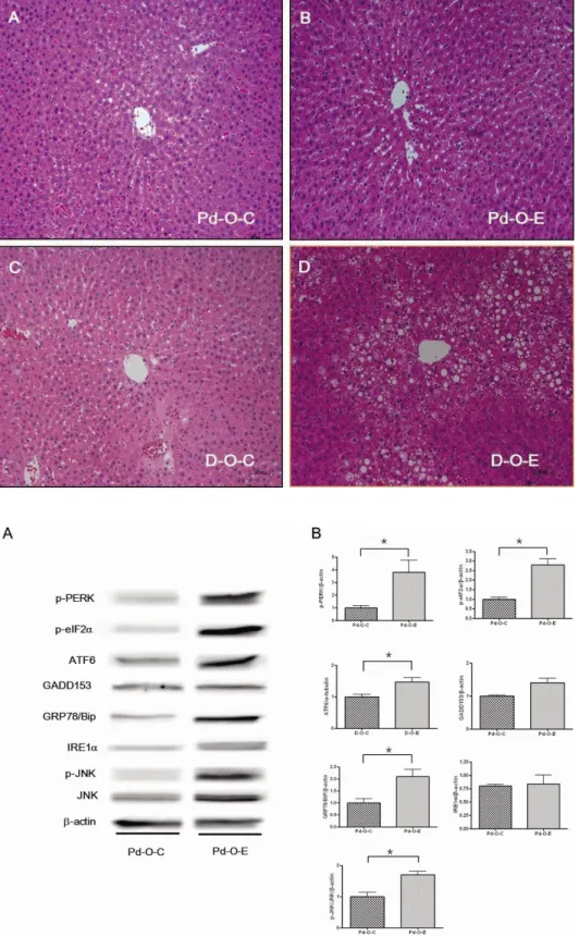 Fig. 5. Effect of alcohol on liver  tissue. (A) Liver section from an  OLETF rat fed control diet from 11  to 16 weeks of age (prediabetes)