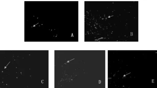 Table 2. Effect of naloxone postconditioning on cell apoptosis  of MIRI rats (mean±SD, n=8)