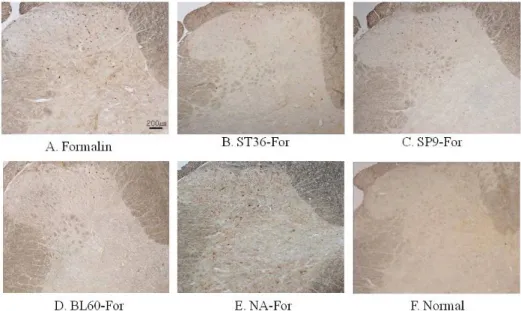 Fig. 4. Representative photographs  of c-Fos-positive neurons in the  dorsal horn of the spinal cord from  different groups