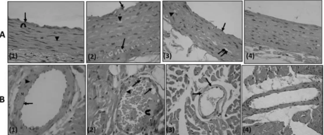 Fig. 8. (row A, B): Row A, A photomicrograph of a transverse section in a rat thoracic aorta (H&amp;E, ×540); (1) Control rat: the tunica  intima lined with endothelial cells (↑), tunica media (M) is relatively thick and formed mainly of wavy acidophilic e