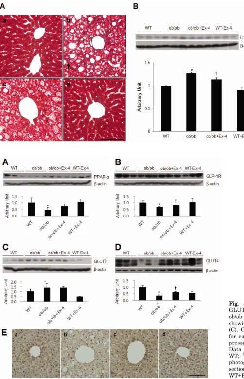 Fig. 4.  Effect  of  Ex-4  on  hepatic  fibrosis in ob/ob mice. (A)  Represen-tative microphotographs of Masson  trichrome staining of liver sections  from WT (a), ob/ob (b), ob/ob+Ex-4 (c),  and WT+Ex-4 (d) mice