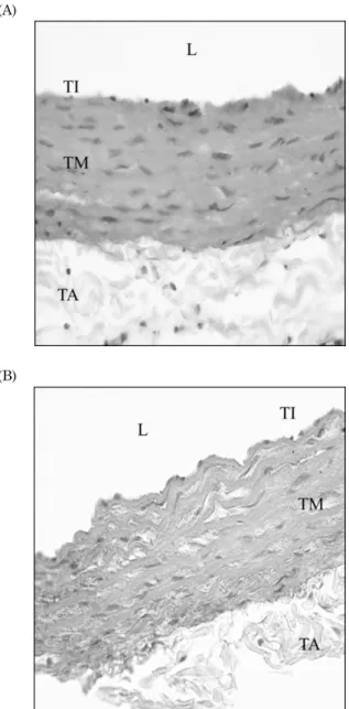 Fig. 3. The histological features of H&amp;E stained sections of aorta  from control and nicotine groups