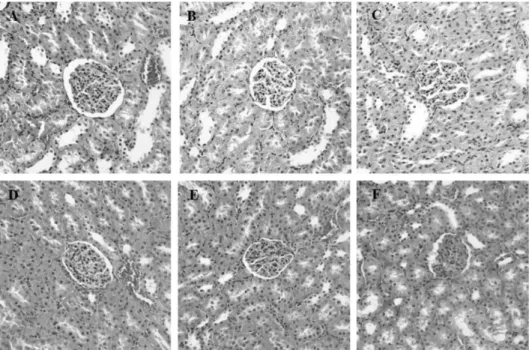 Fig. 4. Effects of PC on LPS-induced  morphological changes and PMN  infiltrations in kidney