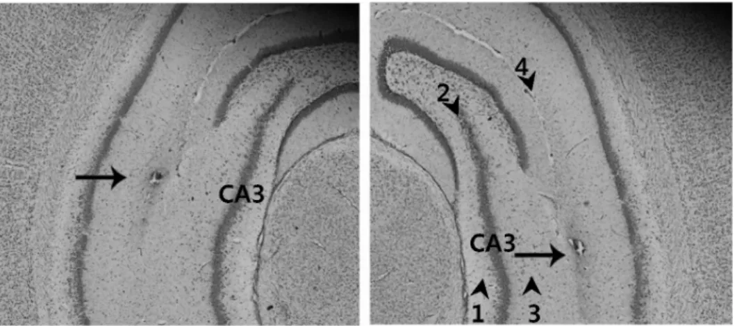 Fig. 1. Verification of the correct  injection of the adenovirus into the  hippocampal CA3