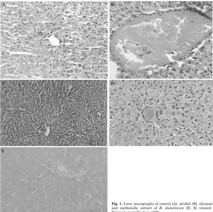 Fig. 1. Liver micrographs of control (A), alcohol (B), silymarin (C)  and methanolic extract of R