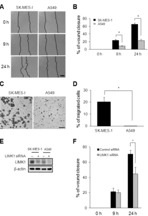 Fig. 4. Invasion in SCC-type (SK-MES-1) and AC-type (A549) cell  lines. (A) Assay of SK-MES-1 and A549 cell invasiveness
