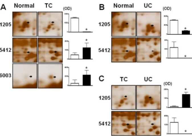 Fig. 1. Muscosal tissue changes in normal, tuberculous and ulcerative colitis patients