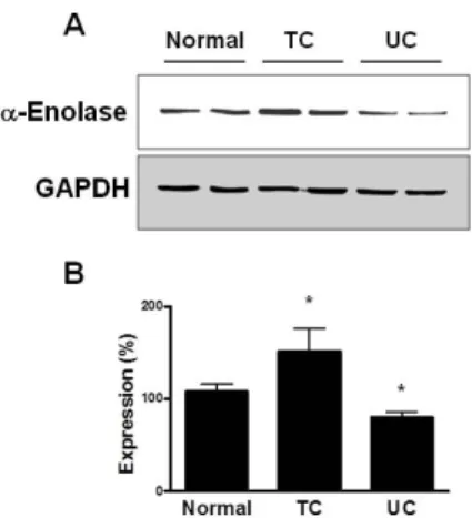 Fig. 5. Expression of α-enolase in human TC and UC mucosal  tissue. (A) Western blot analysis was performed to determine α-  enolalse expression in mucosal tissues from TC and UC patients