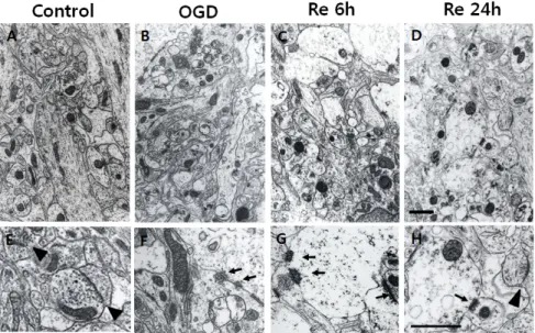 Fig. 2. Electron micrographs of osmium-  uranium-lead-stained stratum lucidum in  the CA3 area of organotypic hippocampal  slice cultures after OGD/reperfusion