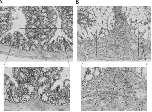 Fig. 1. Photomicrographs of sections  from colon of a control (A) and  TNBS-induced colitis mouse (B)  stai-ned with hematoxylin-eosin