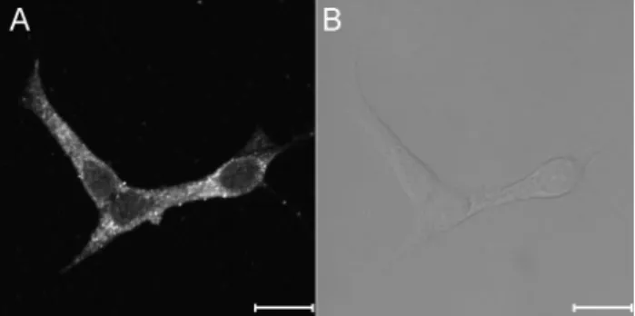 Fig. 5. The expression of ryanodine receptors in INS-1 rat  insulinoma cells. The fluorescence image (A) and the bright image  (B) show the expression and distribution of RyRs in the  intra-cellular compartments