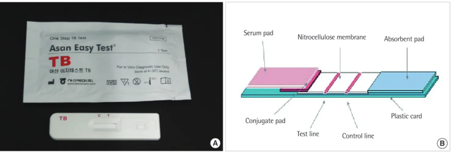 Fig. 2. The sensitivities of Easy Test TB, QFT and a combination of the  two assays in patients with pulmonary and extrapulmonary TB.