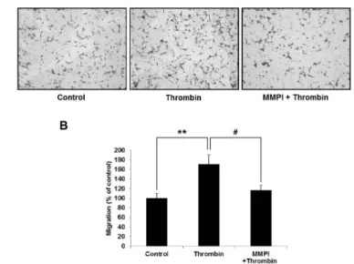 Fig. 5. Effects of thrombin and MAPK or PI3K inhibitors treatment  on MMP-9 expression in mRNA level
