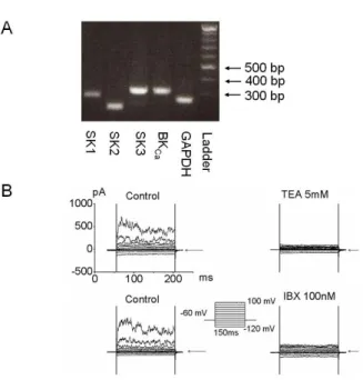 Fig. 1. Functional expression of Ca 2＋ -activated K current in bladder cancer cells. (A) Messenger RNA (mRNA) of ion channels related  to the K Ca  currents was amplified by reverse  transcription-po-lymerase chain reaction (RT-PCR) analysis