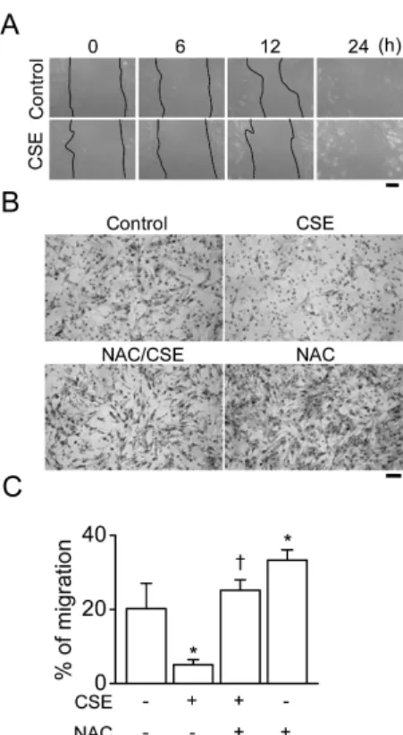 Fig. 3. Effect of CSE on TNF-α secretion and NF-κB activation  in HBSMCs. (A) TNF-α concentration secreted from HBSMCs by  CSE treatment