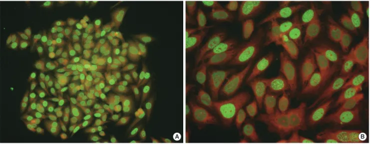 Fig. 3. AIT test of IT-1 cells using the indirect immunofluorescence method. Images depict the pattern of anti-proliferating cell nuclear antigen  (PCNA) antibody binding at a 1:1,280 dilution (A: ×200, B: ×400).