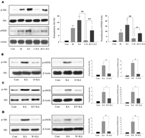 Fig. 2. Effects of L-NAME, ODQ,  KT-5823, and wortmannin on  phospho-rylation of Akt and eNOS