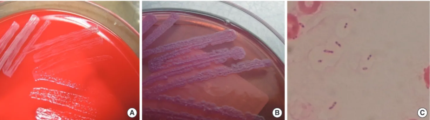 Fig. 1. Colonies on blood agar grew small, smooth and ordinary after 15 hr of incubation (A), but they turned into typical wrinkled appearance af- af-ter 48 hr of incubation (B)