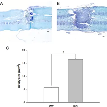 Fig. 1. Motor recovery of hindlimb. Hindlimb motor function on the  contralateral (A) and the ipsilateral side (B) was evaluated before  SCI and on days 1, 4, 7, 10, 13, 17 and 21 after SCI