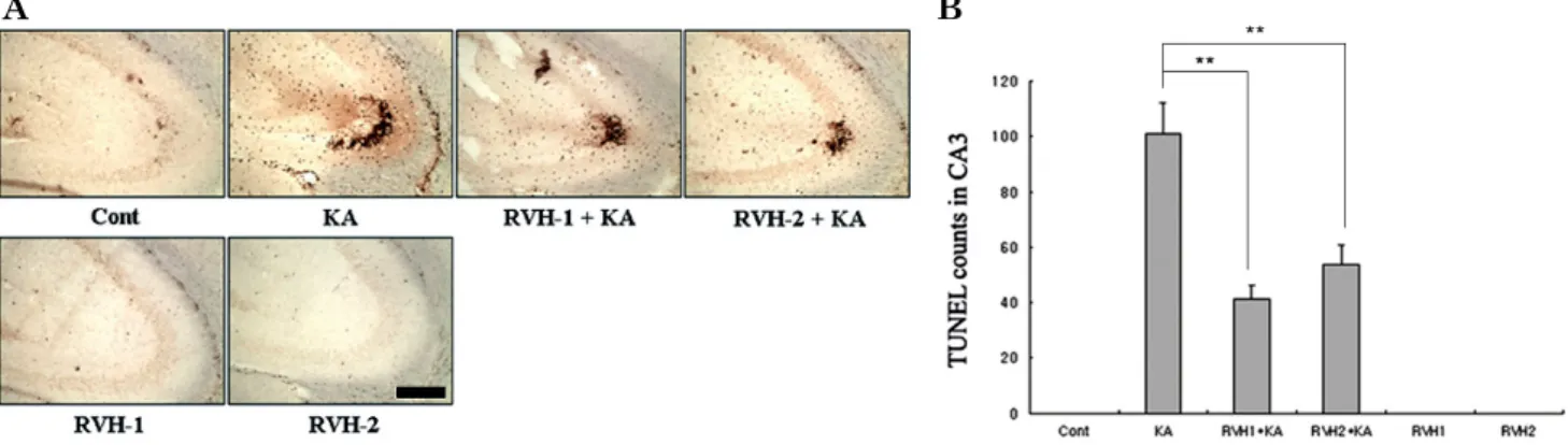 Fig. 3. Representative (A) and quantitative (B) analysis of neuronal cell death with Terminal deoxytransferase-mediated dUTP-nick end  labeling (TUNEL) assay