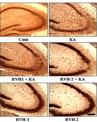 Fig. 5. Suppressive effects of RVH-1 and RVH-2 on KA-induced  microglial activation. Given the previous report that KA-mediated neuronal death accompanies microglial activation, expression of  OX-6, a microglial activation marker, was examined with  immuno