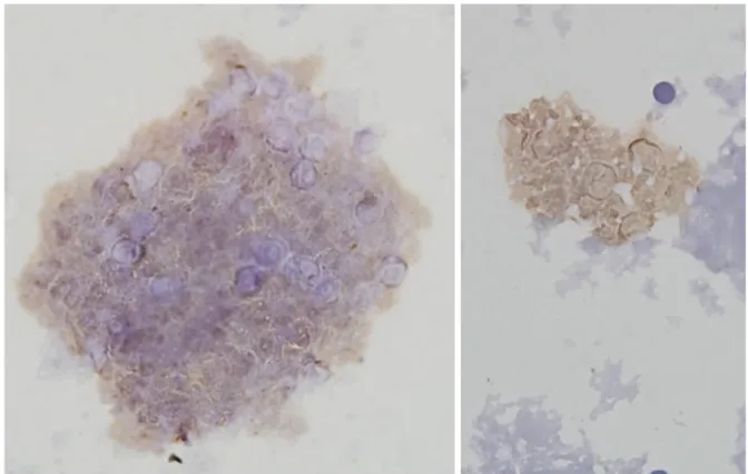 Fig. 3. DHPS mutation study of the patient shows synonymous mutation of Thr55Ala and Pro57Ser
