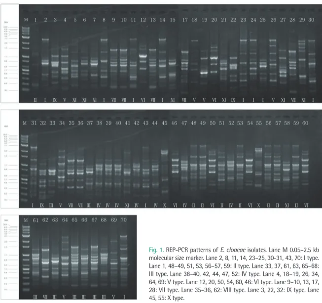 Fig. 1. REP-PCR patterns of E. cloacae isolates. Lane M 0.05–2.5 kb  molecular size marker
