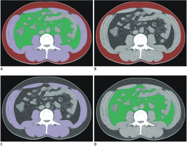 Fig. 5. Example of appropriately evaluated FCN-based segmentation map. 