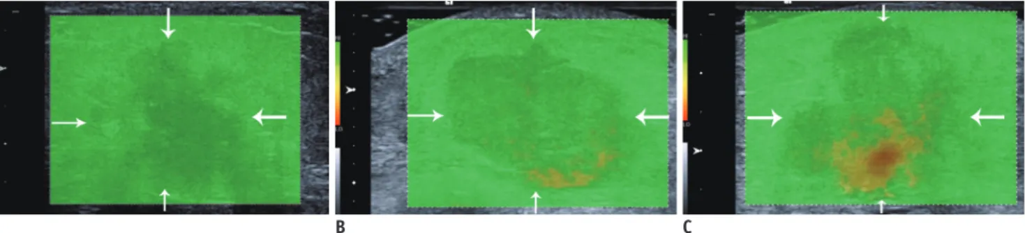 Fig. 1. Study flow diagram.  QM = quality map, SWE = shear-wave  elastography, US = ultrasound