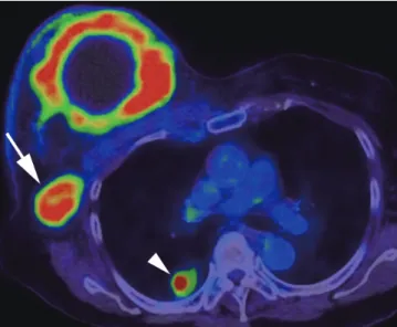 Fig. 8. Size measurement after neoadjuvant chemotherapy. 