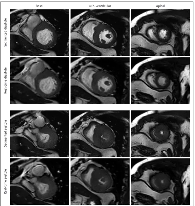 Fig. 2. Representative images of patients without difficulty in breath-holding and arrhythmia
