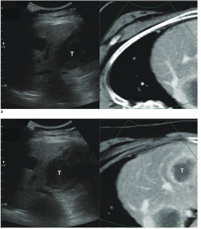 Fig. 6. Improved summative usability for complete image fusion in Ve-CT/Us fusion imaging