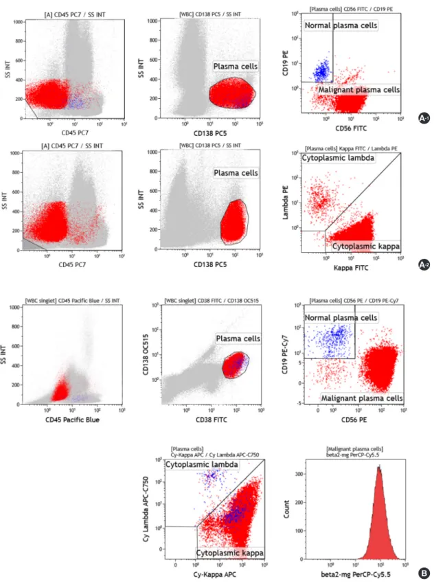 Fig. 1. Representative example of flow cytometric immunophenotyping using two methods to distinguish between neoplastic plasma cells and re- re-active plasma cells in a patient with multiple myeloma