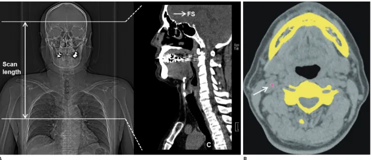 Fig. 2 Representative images of airway CT scans.