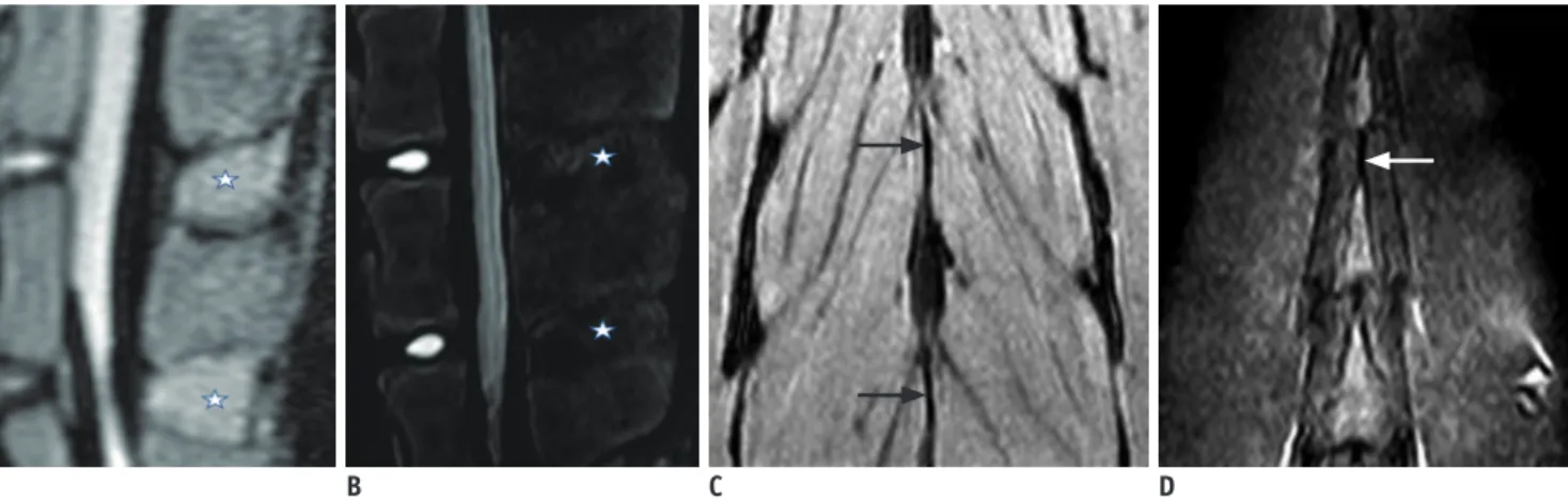 Fig. 3. Normal ISL appearance. 