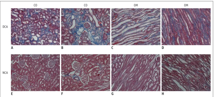 Fig. 6. Representative micrographs of kidney with Masson’s trichrome staining.