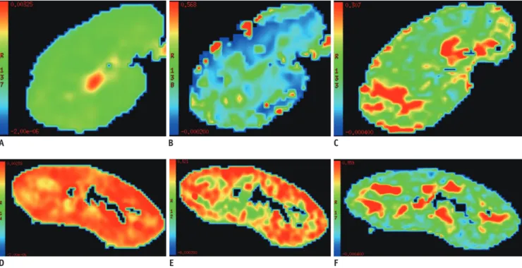 Fig. 1. Comparison of diffusion images (ADC T , F P , and FA color-coded maps) between patients with poor and good renal allograft  function