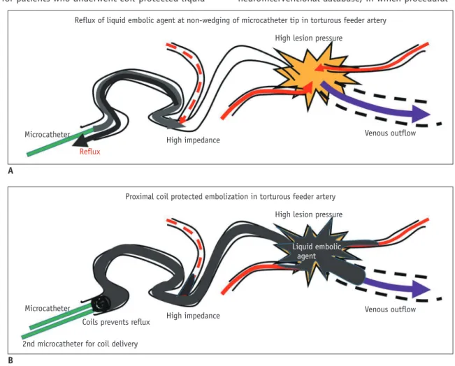 Fig. 1. Illustration of coil-protected technique. 