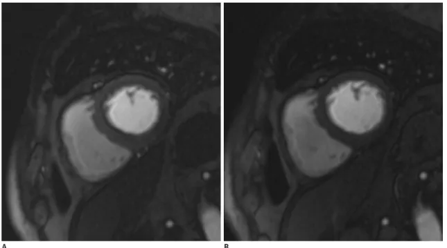 Fig. 9. Dark rim artifact during perfusion magnetic resonance imaging. 