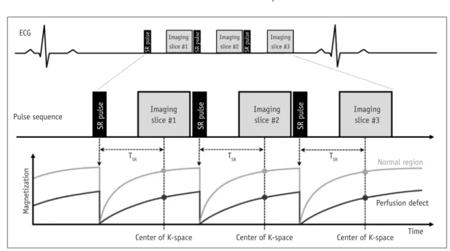 Fig. 8. First pass perfusion sequence.  ECG = electrocardiogram, SR = saturation, T SR  = SR time