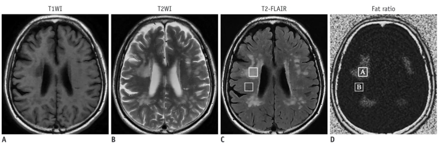 Fig. 2. 42-year-old man with apathy, dystonia, and hyperactive deep tendon reflexes. 